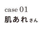 case01 肌あれさん