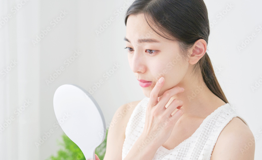 肌荒れに悩む女性